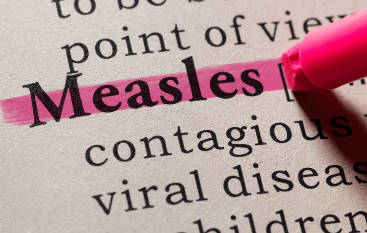 Measles